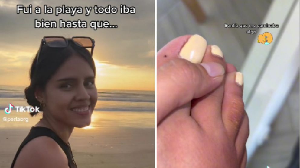 La terrible experiencia que padeció una joven luego de caminar descalza por una playa (Imagen captura vídeo).