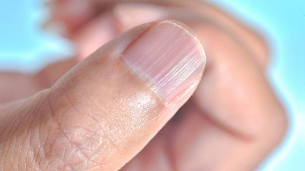 Los fumadores también pueden cambiar el tono de las uñas, debido al contacto directo con el cigarrillo.