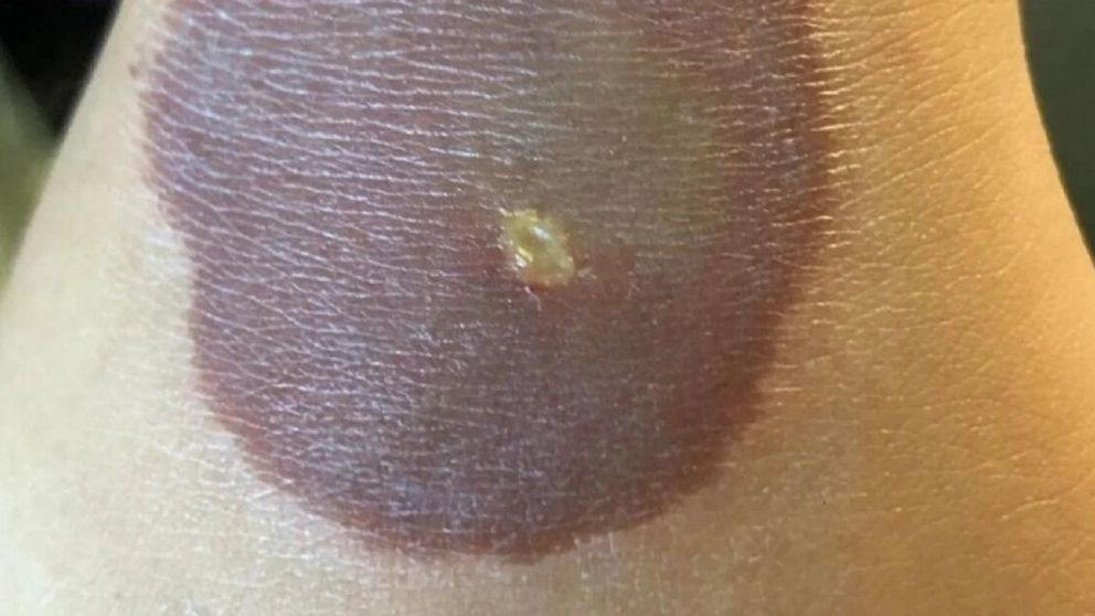 La nena de 10 a�os realizaba el desaf�o de TikTok de �la mano helada�.