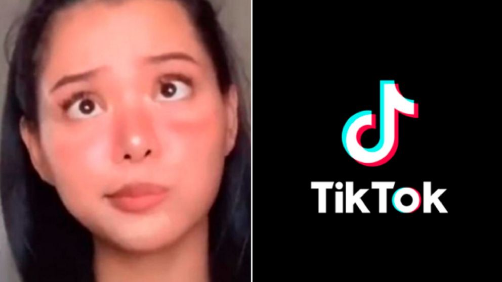 Este es el video con más likes en la historia de TikTok.