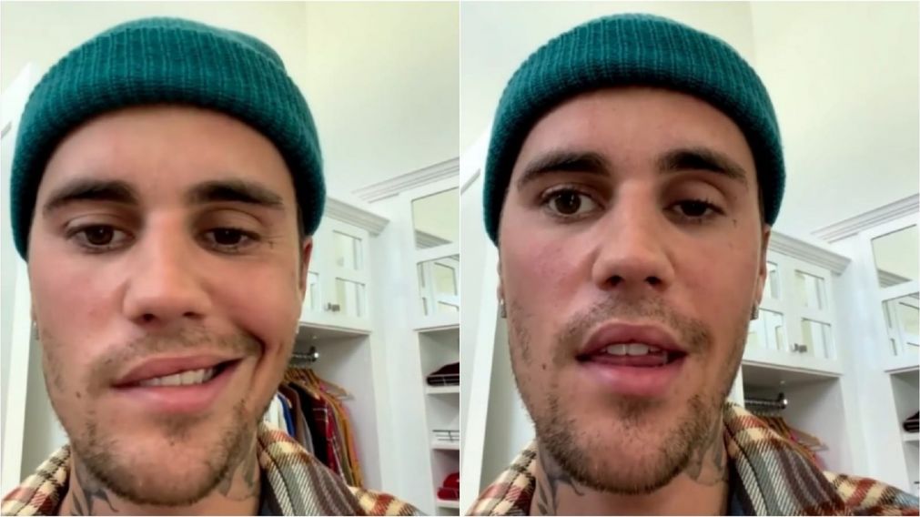 La extraña enfermedad que afectó a Justin Bieber.