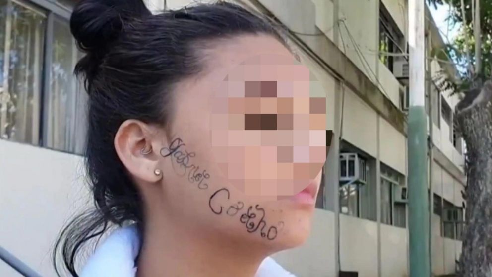 La joven con el nombre de su ex tatuado en el rostro (Gentileza T13.cl).