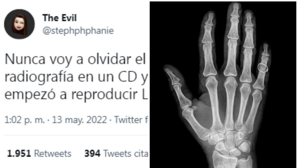 Una médica residente de traumatología y ortopedia mexicana contó una situación insólita en Twitter y se hizo viral.