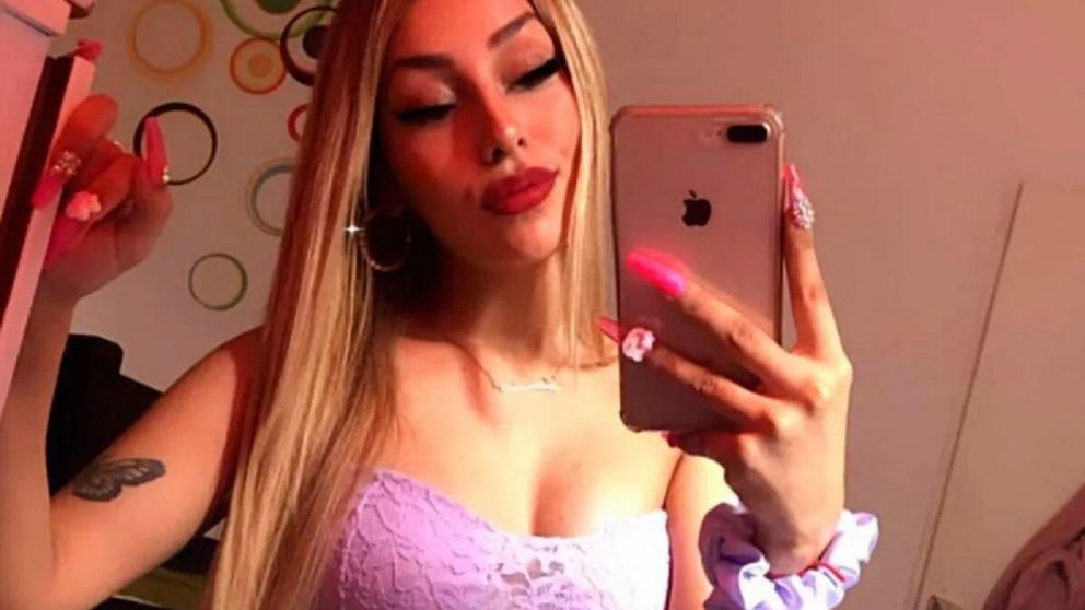 Tamara B�ez comparti� con sus m�s de 416.000 seguidores de Instagram el resultado de sus �ltimos retoques est�ticos.