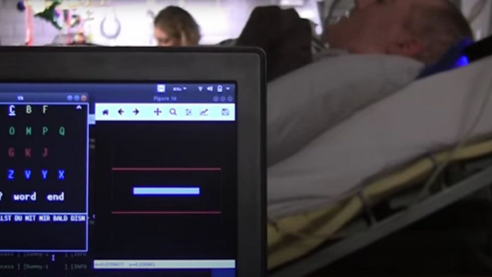 Este chip es un gran avance para los enfermos de ELA.