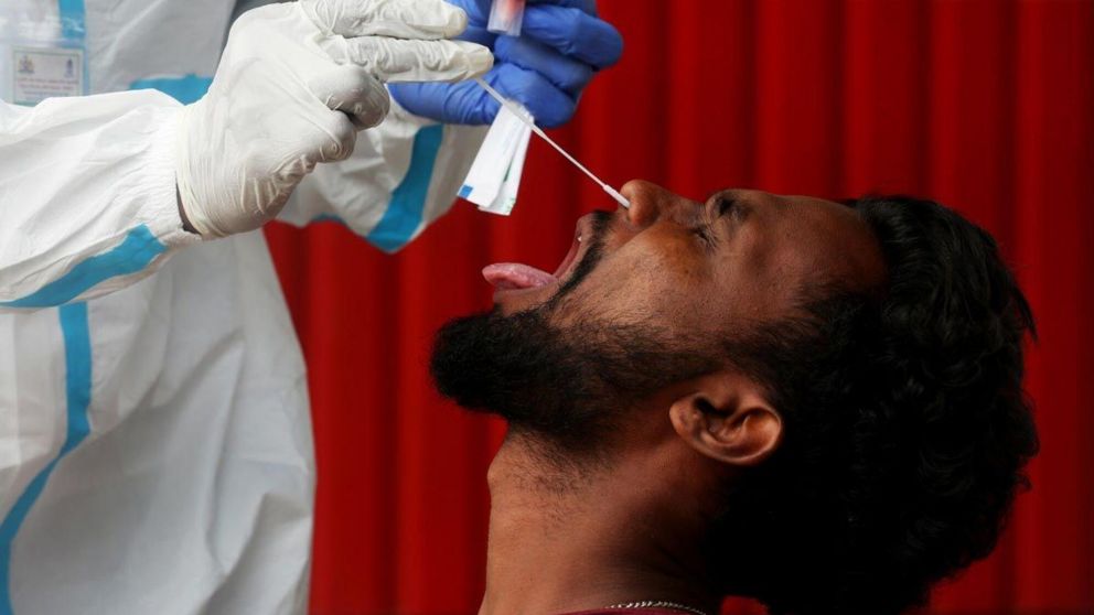 Existen ciertas afecciones "long Covid" que pueden ser mortales.