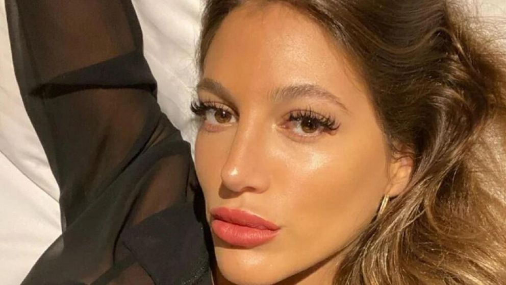 Marian Farjat se sometió a una rinoplastía en 2017 que se dejó graves secuelas. (eltrecetv.com.ar)