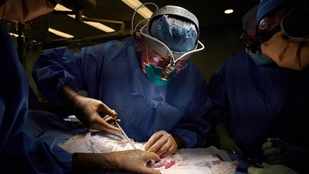 Se trata del tercer xenotrasplante conocido en los �ltimos meses.