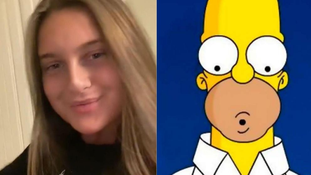 Una tiktoker de 22 a�os tuvo que ser internada por colocarse relleno en los labios.