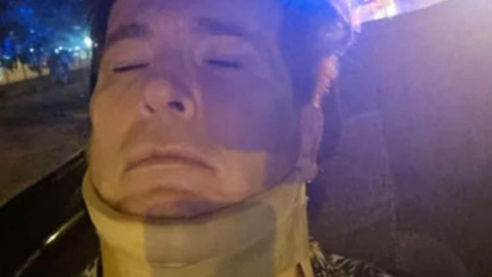 El mediático actor sufrió daños en sus riñones, clavícula y cervicales.