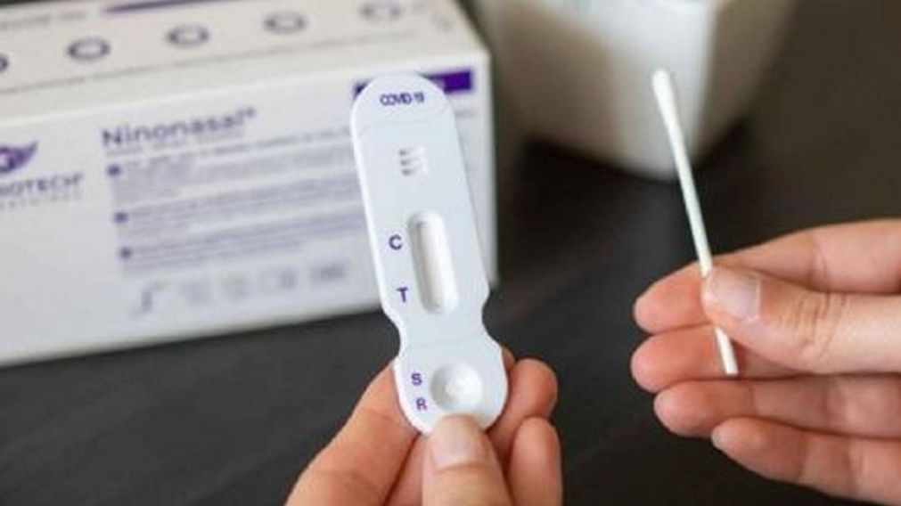 En los próximos días llegarán al país los autotest de coronavirus y se podrán adquirir en las farmacias.