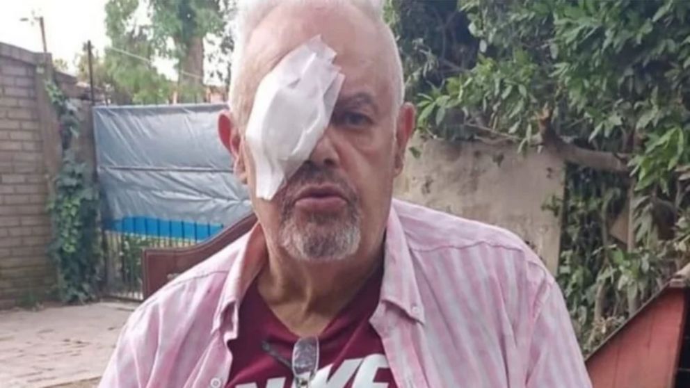 El remisero perdió la visión del ojo derecho producto del ataque.