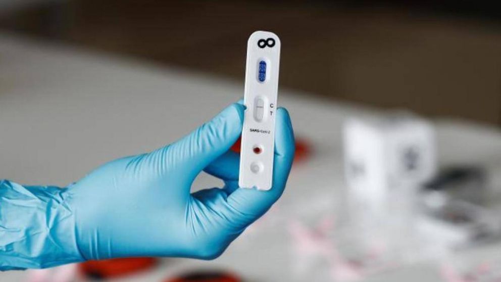 El autotest de Covid-19 se venderá en las farmacias.