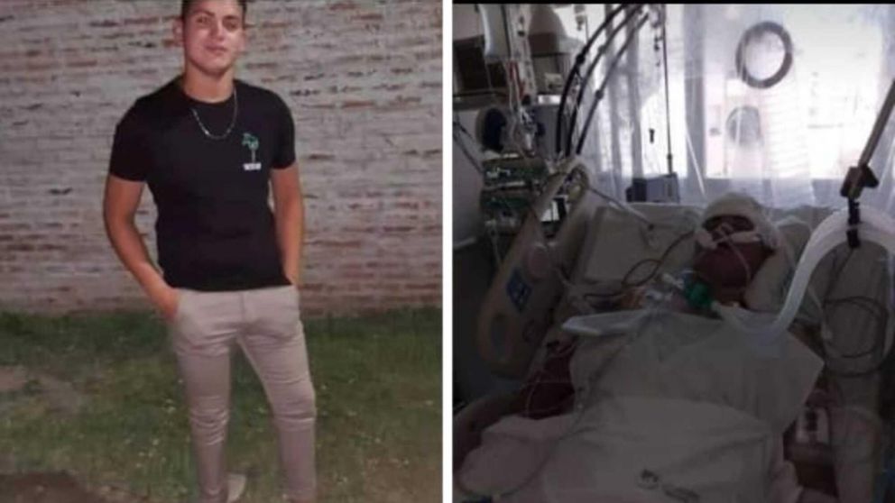 Franco Gabriel Benavídez, de 20 años, lucha por su vida.