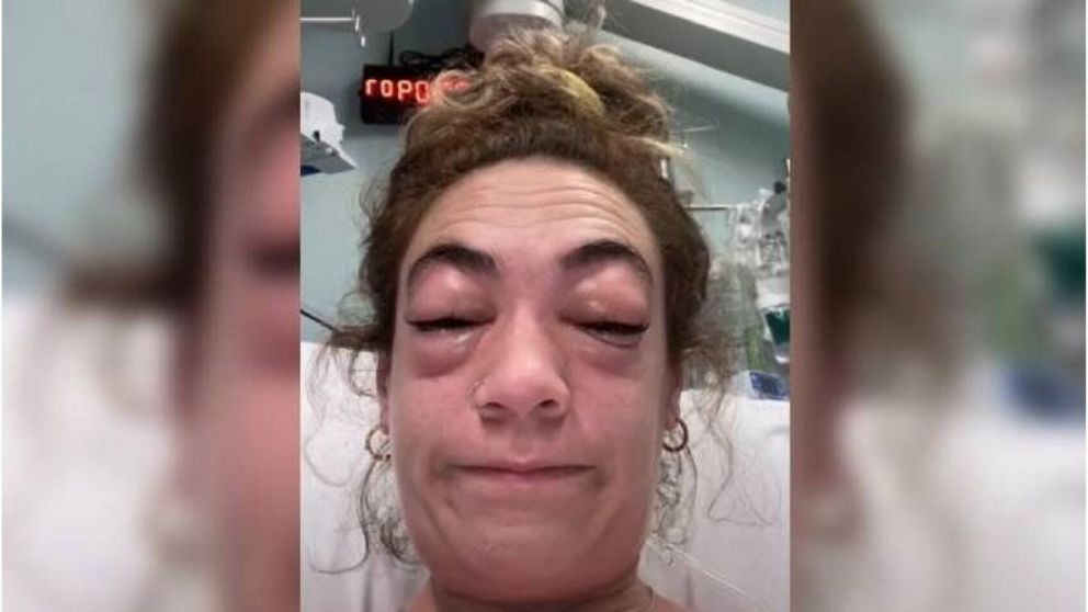 Una joven se puso extensiones de pestañas, pero ocurrió algo inesperado y el vídeo se viralizó (imagen captura vídeo).