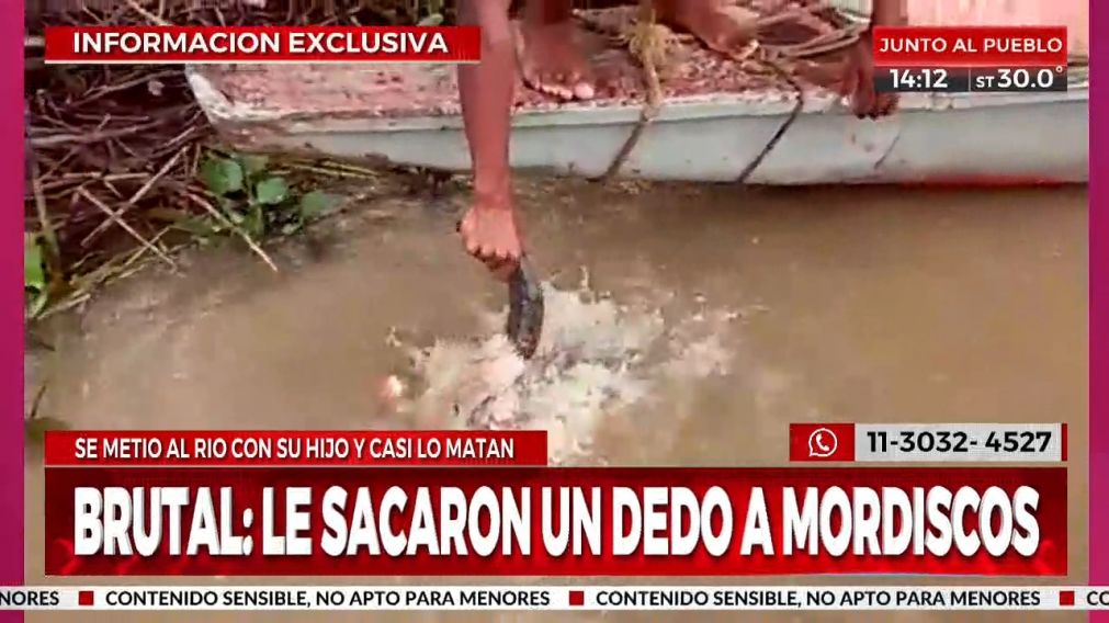 Sangriento ataque de palometas a padre e hijo: le comieron dos dedos del pie.