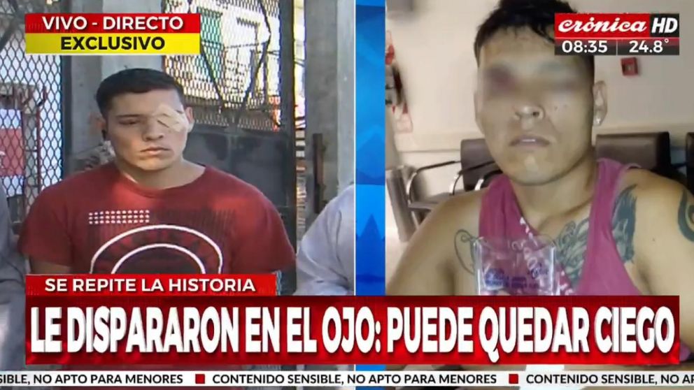 Esteban López, de 25 años, fue baleado por policías en Rafael Castillo (Crónica HD).