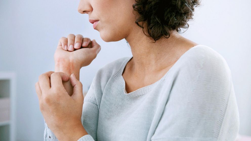 La psoriasis tiene diversos tratamientos (Imagen ilustrativa).