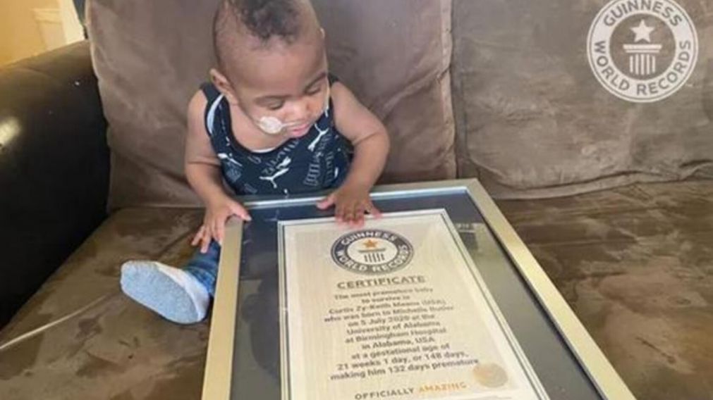 Nació a las 21 semanas y ahora recibió el premio al "bebé más prematuro" del mundo (imagen Guinnes Word Récord).