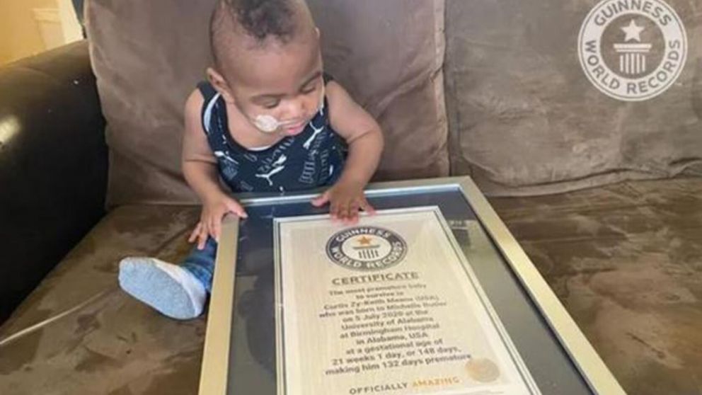 Nació a las 21 semanas y ahora recibió el premio al "bebé más prematuro" del mundo (imagen Guinnes Word Récord).