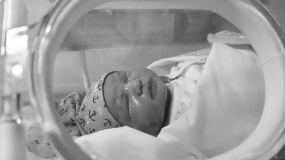 Bebé nació con una "cola humana" de 12 centímetros de largo y sorprendió a los médicos (imagen ilustrativa).