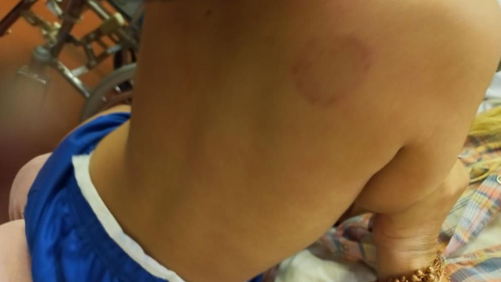 Una de las heridas que presenta el menor de dos años.