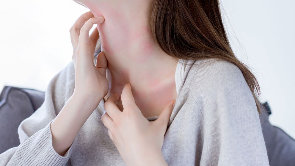 En primavera: ¡llega la alergia!