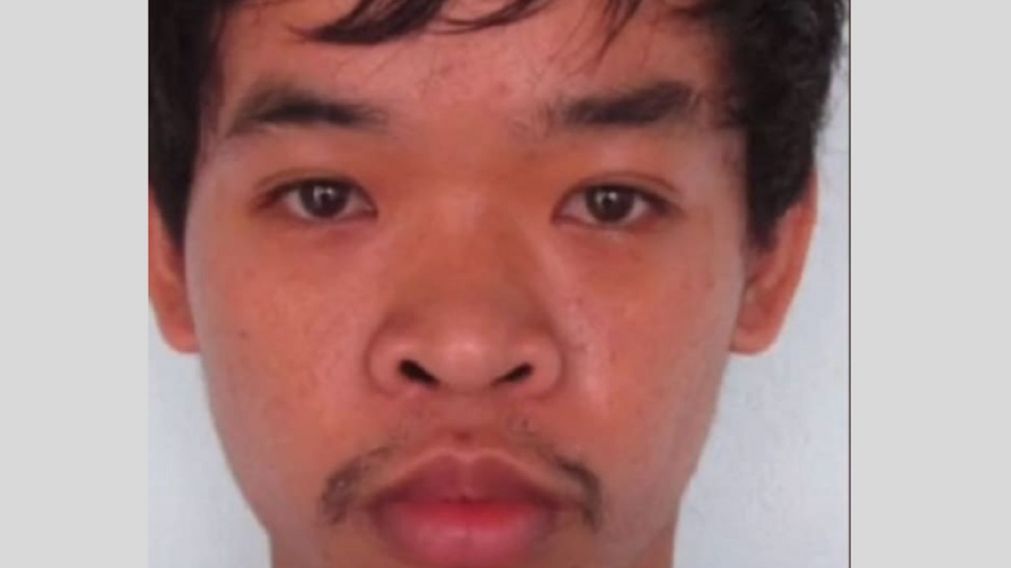 El joven gastó más de 17 mil dólares en operaciones en las que modificó sus pómulos, ojos y labios.