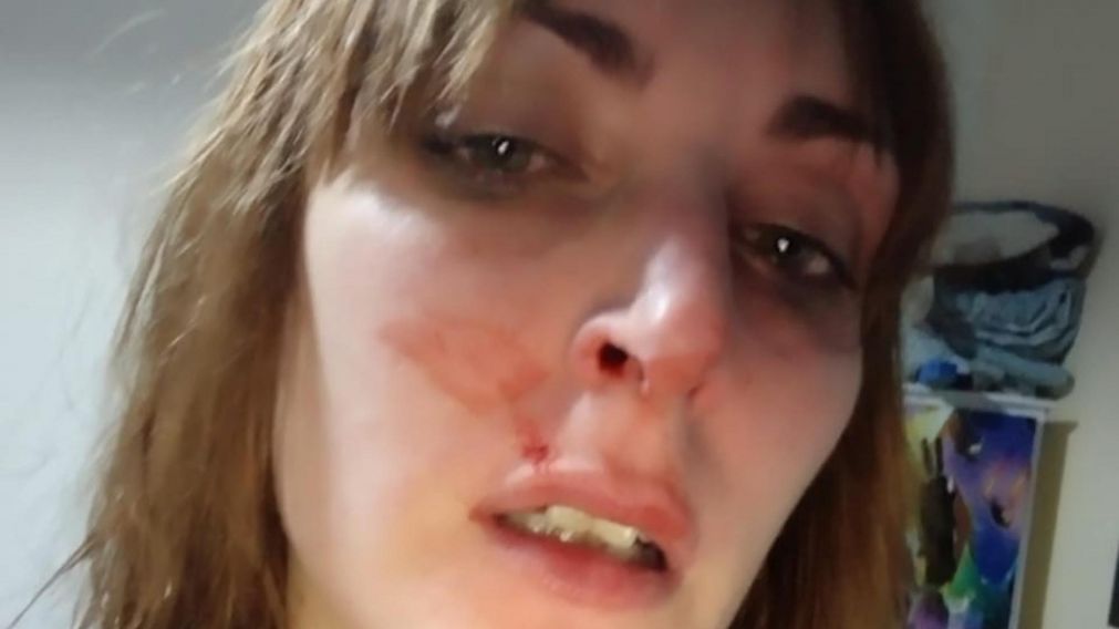 Denunci� a Luis Tagliapietra, querellante del ARA San Juan, por violencia de g�nero: "Me duele toda la cara, y amenaz� a mi mam� por haber subido todo a las redes"
