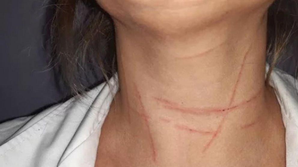 El agresor sexual la abordó desde la puerta del acompañante y con amenazas la obligó c conducir hasta un terreno baldío. (Gentileza: 0223)