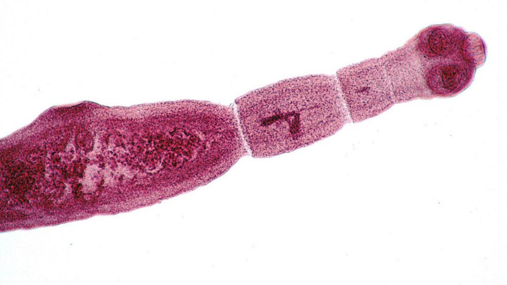 Varios casos de la enfermedad parasitaria equinococosis alveolar fueron encontrados en Estados Unidos y Canadá (Genttileza RT)