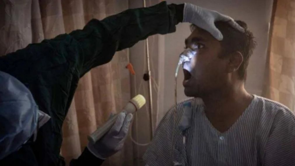La mucormicosis es una enfermedad con alta tasa de mortalidad