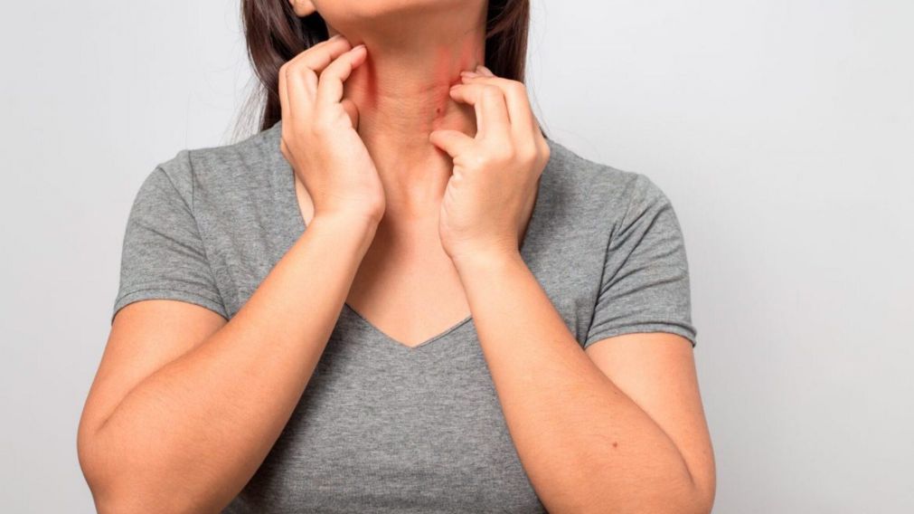 Existen diversos tratamientos para el lupus (Imagen ilustrativa).