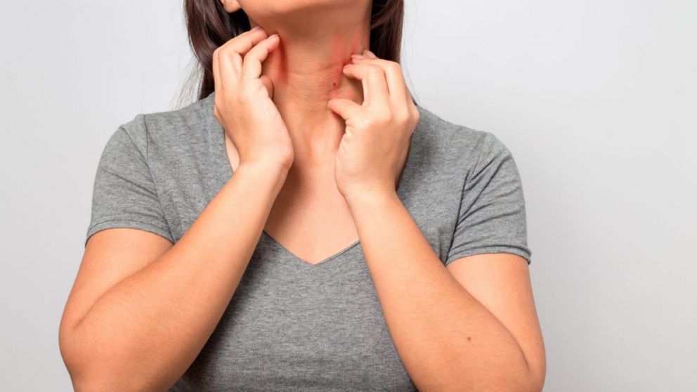 Existen diversos tratamientos para el lupus (Imagen ilustrativa).