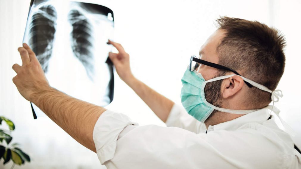 Los pacientes post Covid-19 muestran pulmones que parecen estar casi completamente blancos, es decir, severamente dañados.