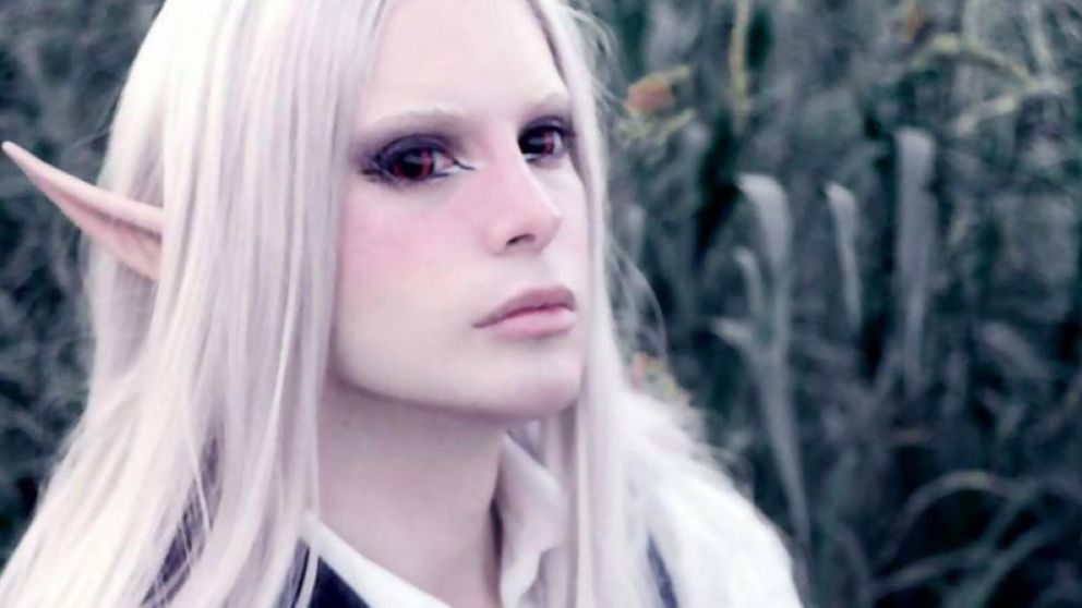 Un joven invirtió 85 mil dólares en más de 30 cirugías para parecerse un elfo.