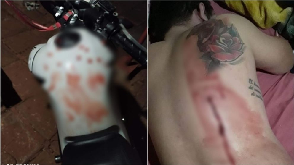 Los jóvenes fueron llevados de urgencia al hospital más cercano.