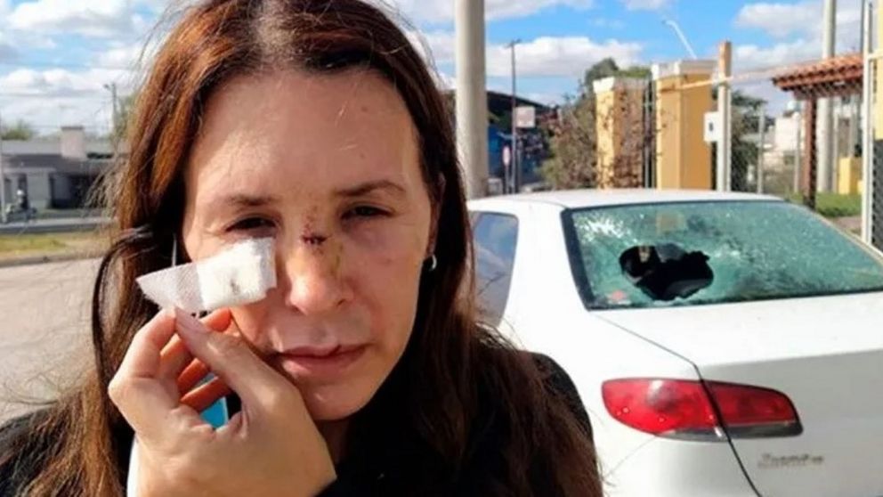 La mujer sufrió varias lesiones en su rostro y cabeza.