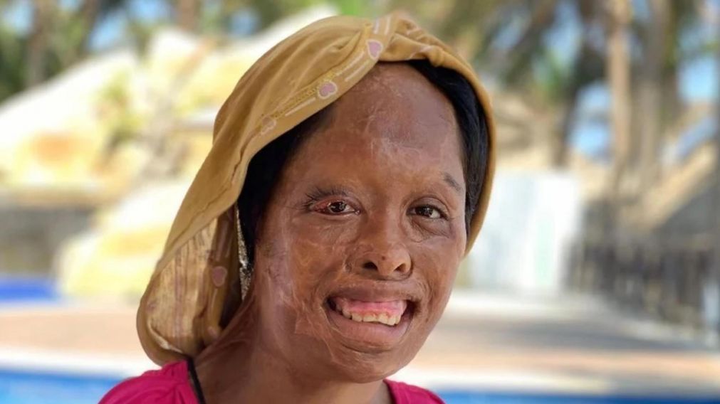 Juanita, la nena de 12 a�os que fue quemada, golpeada y vendida por su padre en M�xico