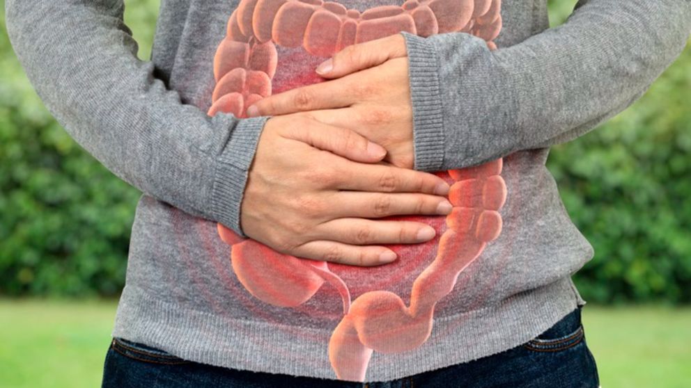 En el Día Mundial de las Enfermedades Inflamatorias Intestinales, expertos recomiendan no abandonar los tratamientos.