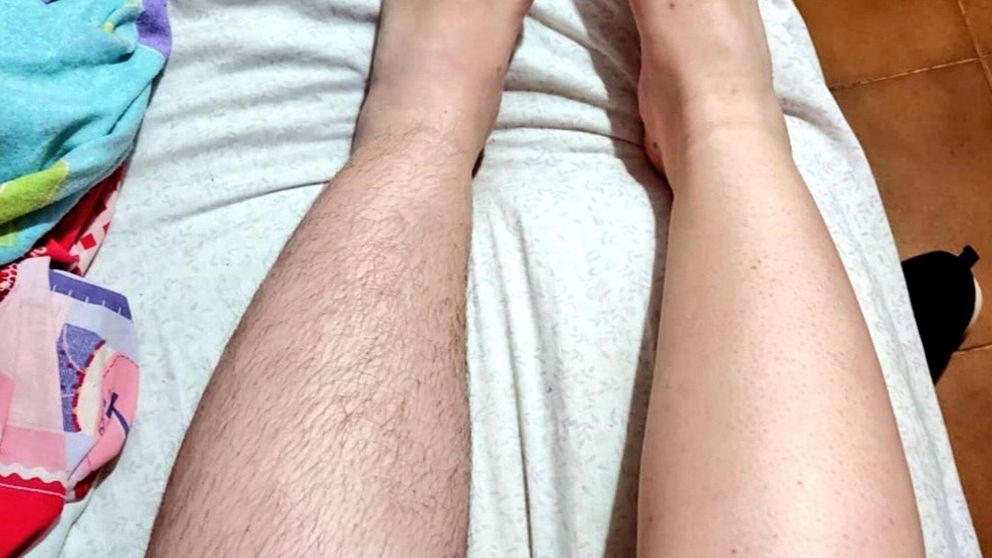 La foto con la que la usuaria española comenzó su hilo de Twitter en el que reflexiona sobre la depilación.