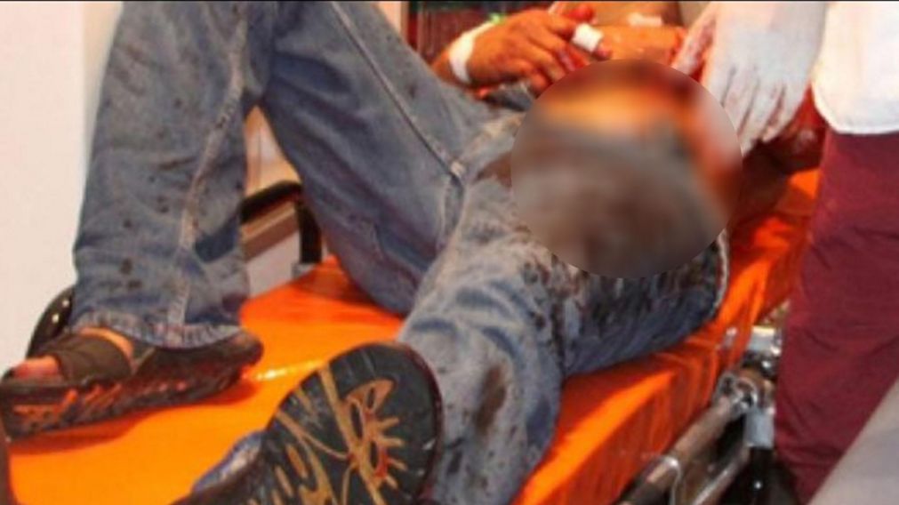Lo apu�alaron, lleg� de urgencia al hospital y "raj�" antes de ser atendido.