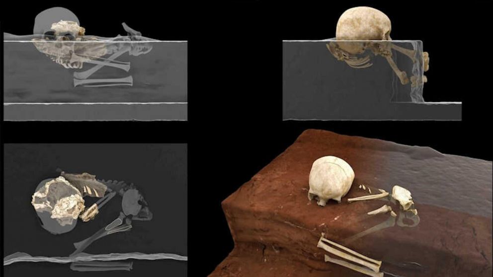 La autopsia virtual a los restos �seos de Mtoto.