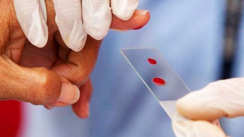 Hemofilia: un buen control es suficiente para llevar una vida "normal" (Imagen ilustrativa).