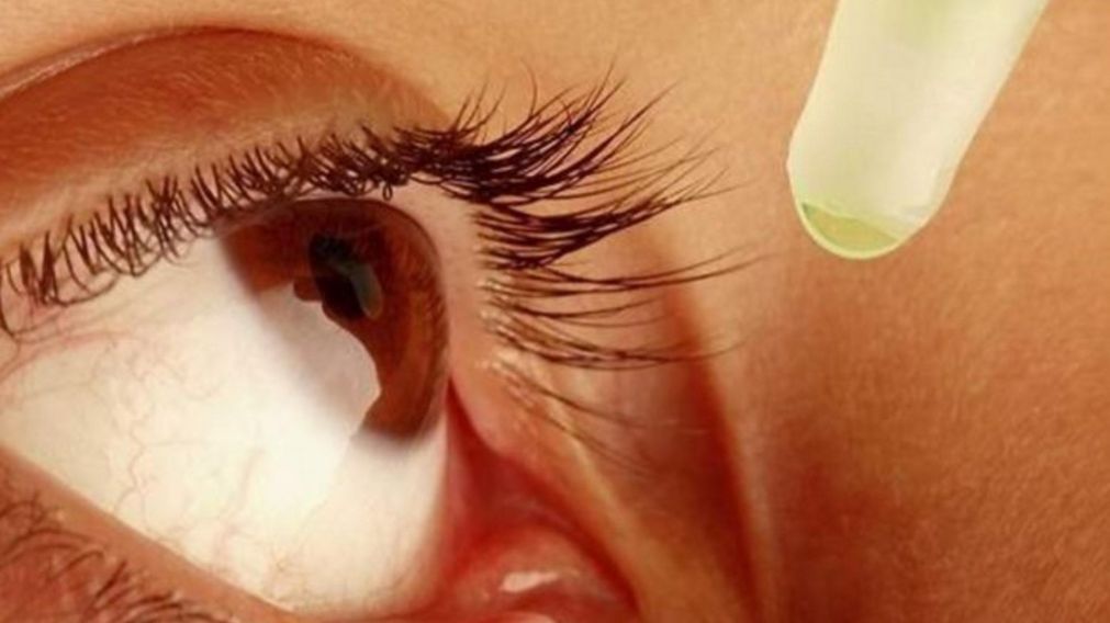 Confundi� pegamento para u�as con gotas para ojos y casi pierde la visi�n.