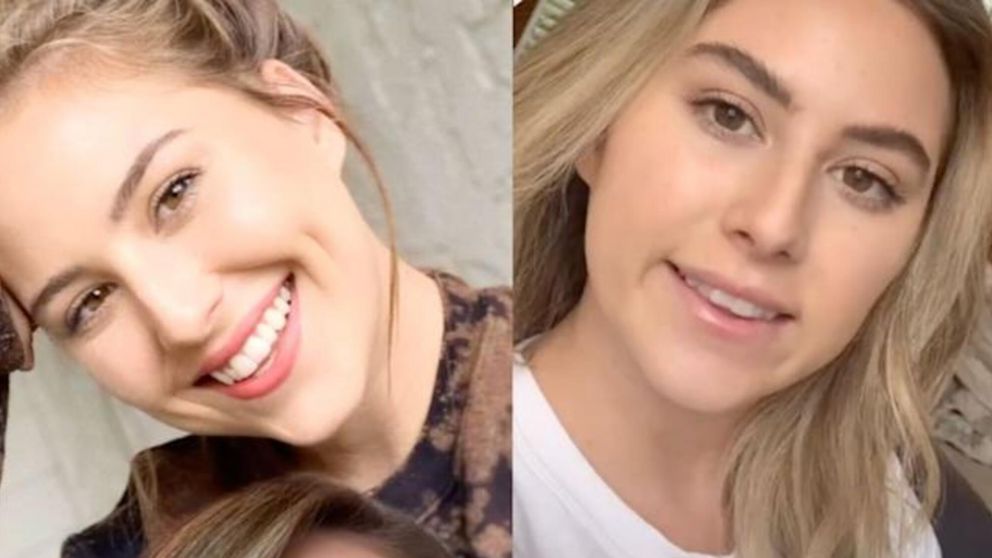 La tiktoker, Montanna Morris, reveló como el bótox le arruinó la sonrisa.
