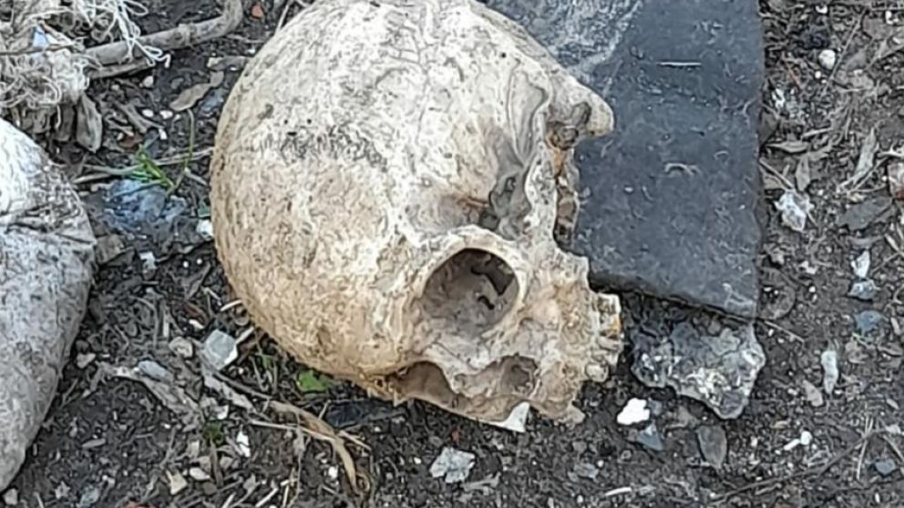 En encuentran un cráneo en Peralta Ramos