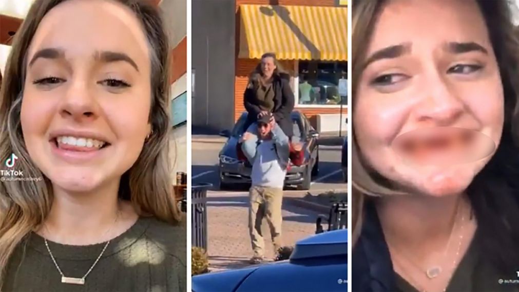 El video en el que la mujer mostr� c�mo le qued� la dentadura se hizo viral a los pocos minutos.