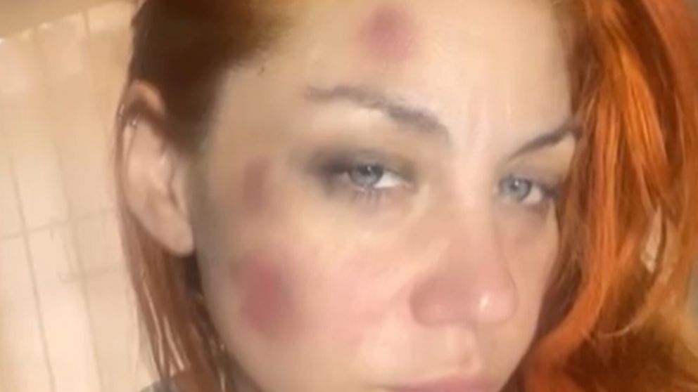 Lourdes había denunciado a una expareja,