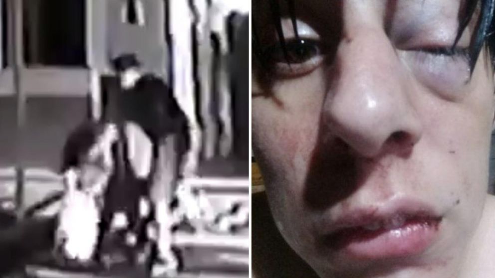 El joven de 24 a�os fue atacado en Evita al 1100, en Esteban Echeverr�a.